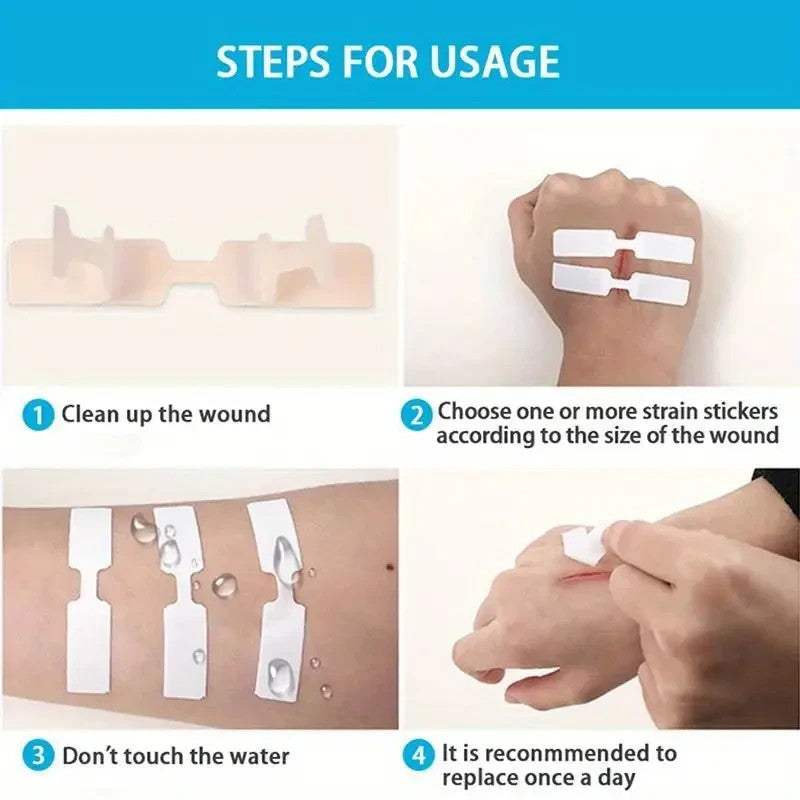 Sterile Stitching Threads Pack of 40 - Emergency Suture Kit for First Aid & Travel